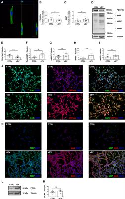 Human Wharton’s Jelly Mesenchymal Stromal Cell-Derived Small Extracellular Vesicles Drive Oligodendroglial Maturation by Restraining MAPK/ERK and Notch Signaling Pathways